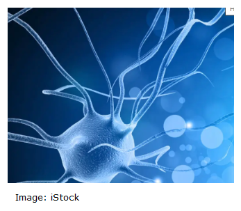 Cleanascite™ Cited in Proteomic Study of Neurodegeneration Associated with Aging